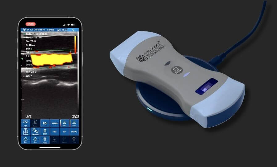 About FAGONEX healthcare technology company specializing in portable ultrasound and POCUS solutions