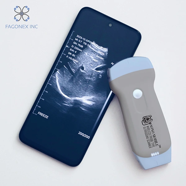 Sono Mobile CL52