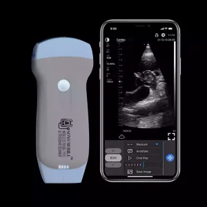 handheld ultrasound fagonex BUYING 1