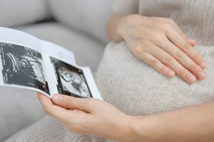11 Week Ultrasound
