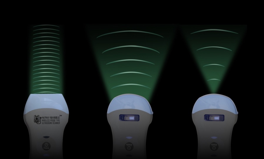 Sono Mobile handheld ultrasound device featuring dual-head probe design with convex, linear, and phased array imaging capabilities for versatile point-of-care scanning in clinical environments.