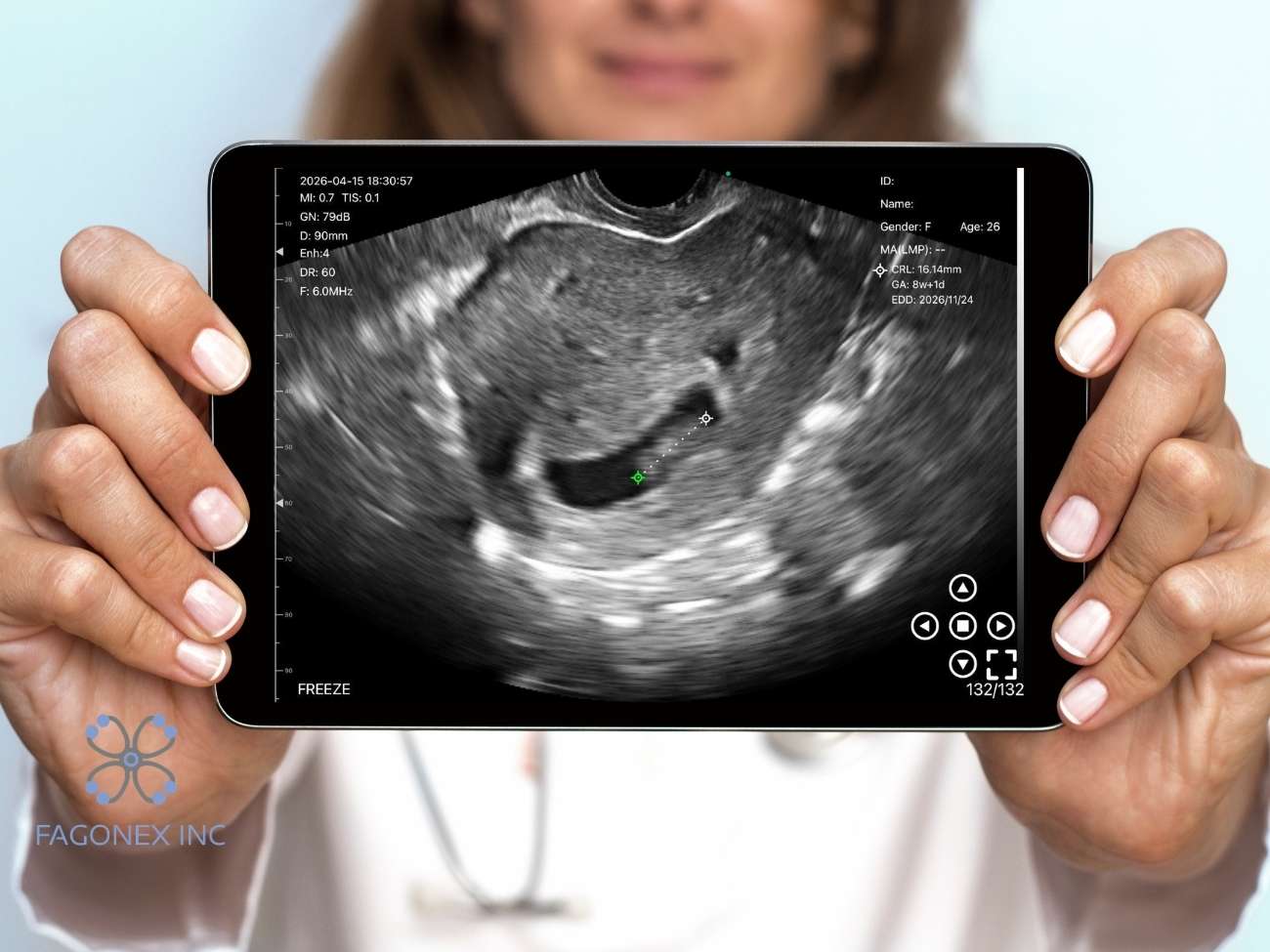 Doctor showing Sono Mobile™ ultrasound exam on a tablet