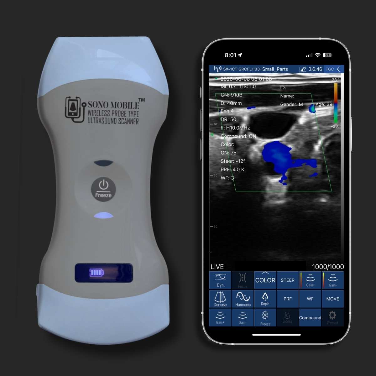 Sono Mobile wireless handheld ultrasound device beside a smartphone during point-of-care ultrasound scanning.