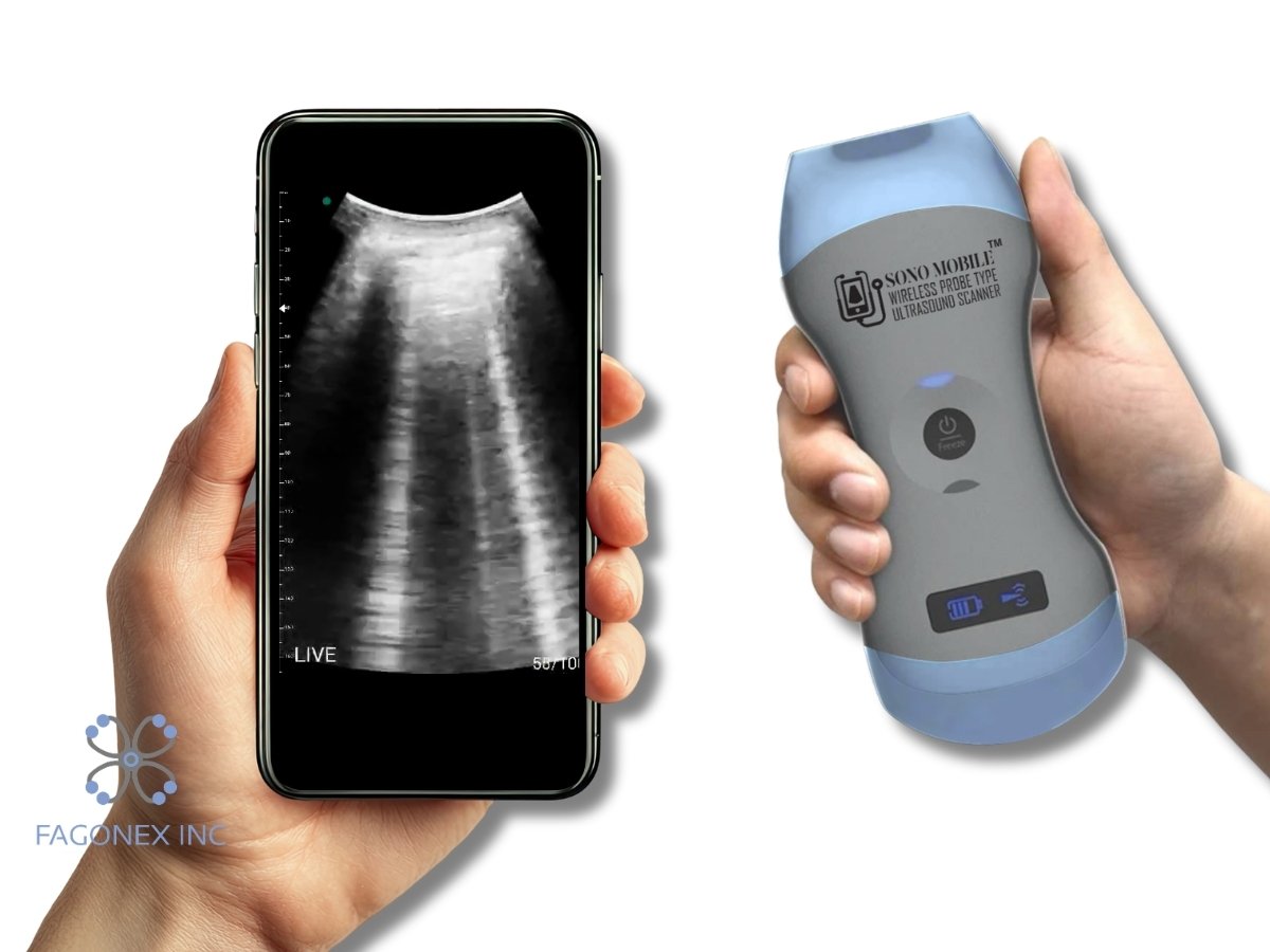 Doctor performing lung ultrasound scan